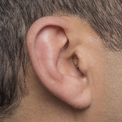 Completely-In-The-Canal (CIC) Hearing Aids